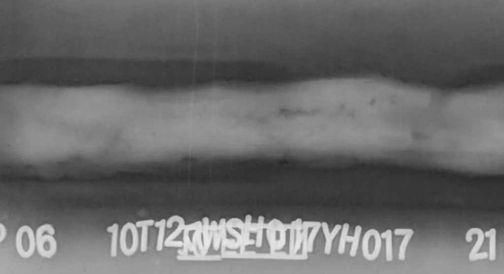 焊缝工业射线底片原始图像,用于展示FS50B 扫描仪的高分辨率数字化效果。