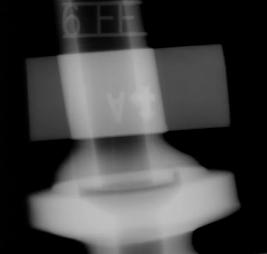 工业零件射线底片数字化原始图像,显示未经过Flash! 智能处理前的检测画面。